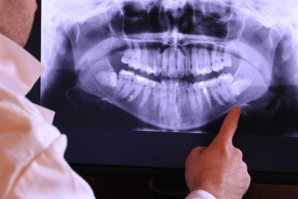 Best 24-Hour Emergency Dentist in San Andreas, CA