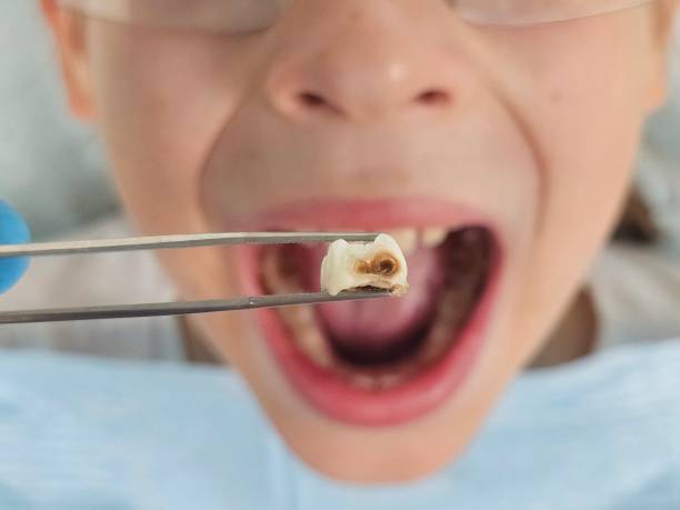 Best Weekend Emergency Dentist in San Andreas, CA