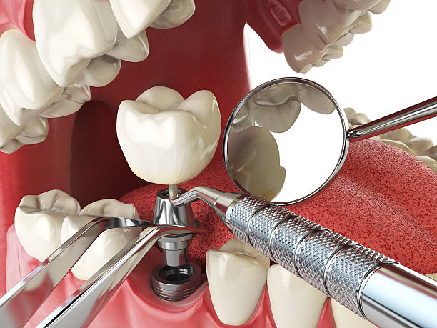Best Cosmetic Emergency Dentistry in San Andreas, CA